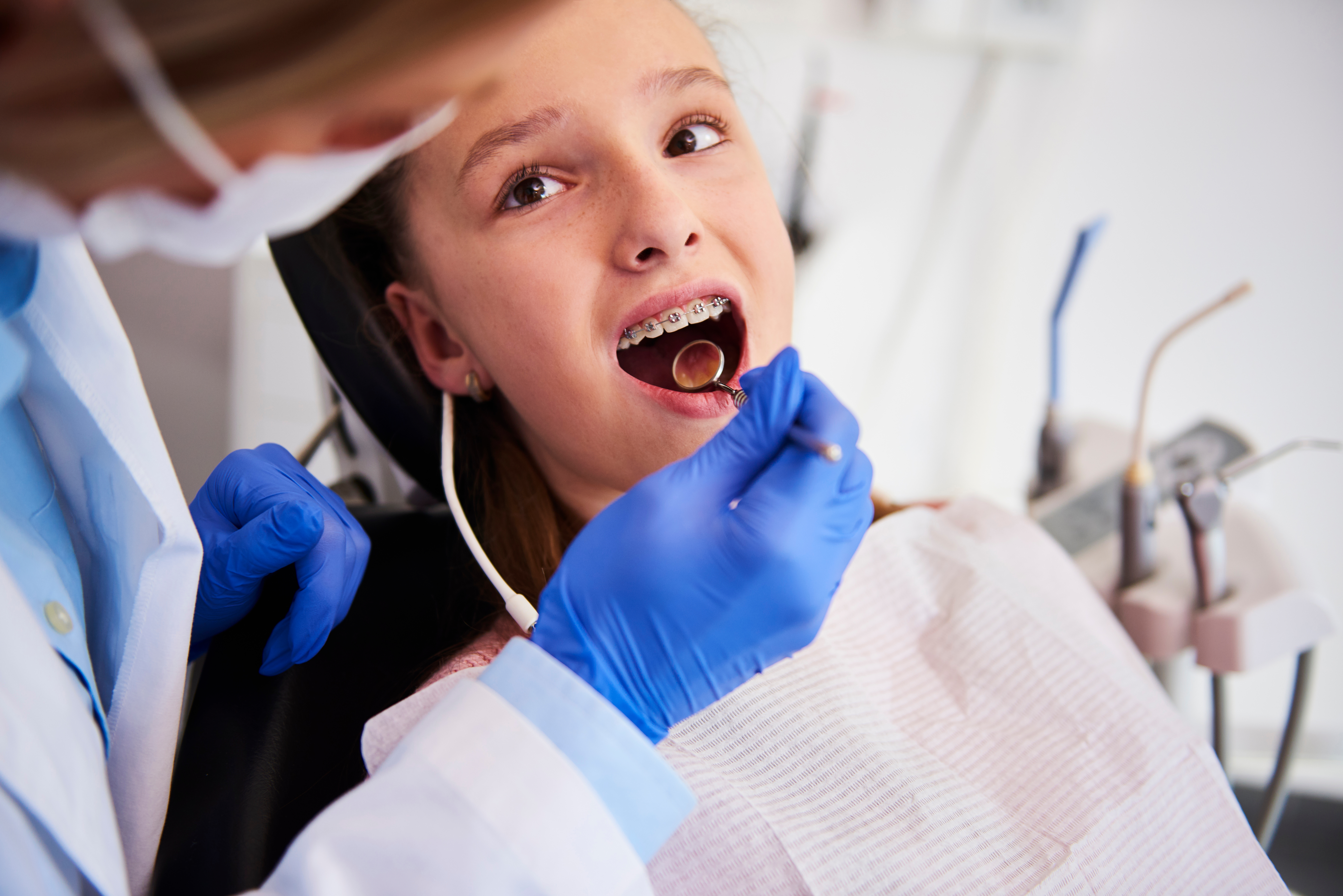 best time to start braces, Invisalign for kids in Edmonds, WA